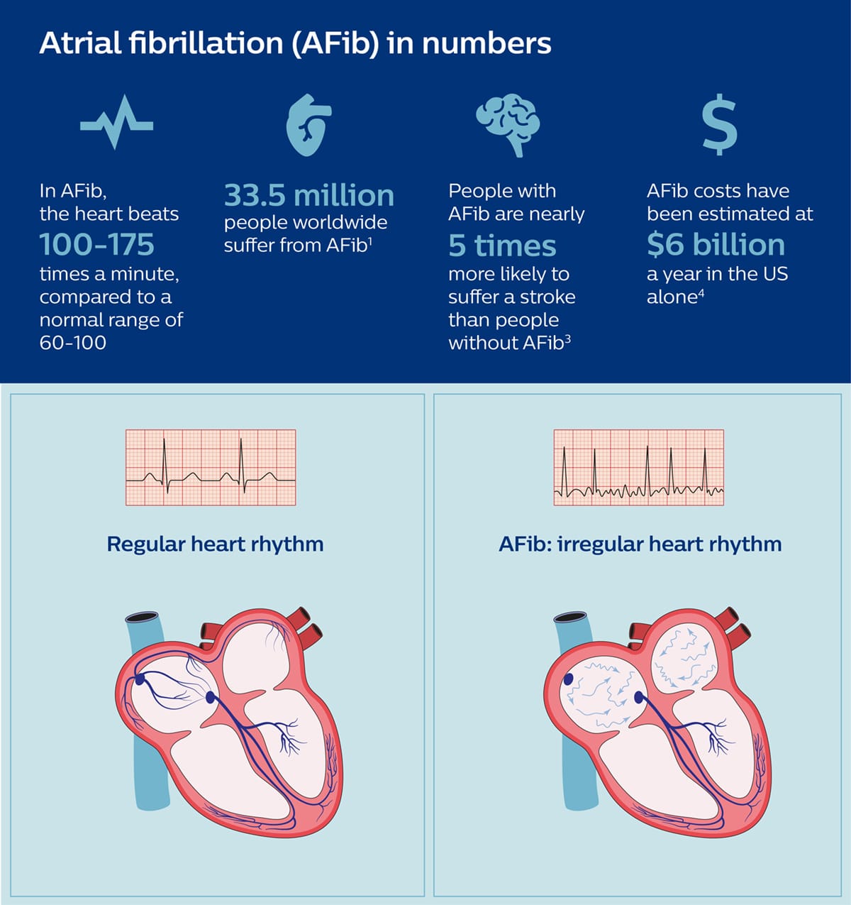 Atrial Fibrillation infographic