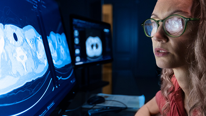 The future of AI in radiology is the AI you barely notice