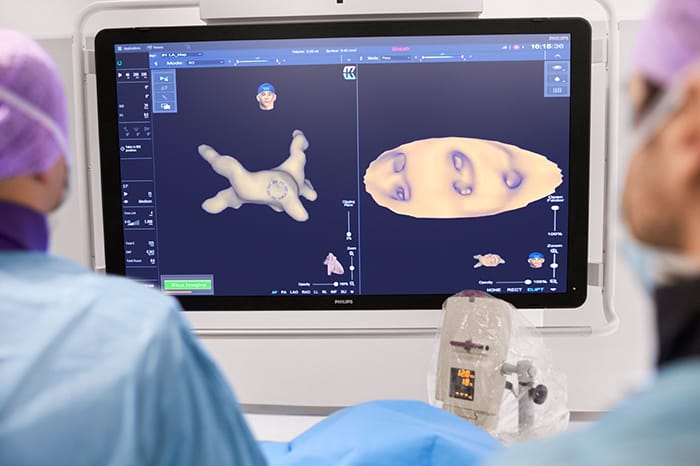 Philips&rsquo; KODEX-EPD platform uses dielectric imaging to create high-definition 3D images of a patient&rsquo;s cardiac structures, in real time