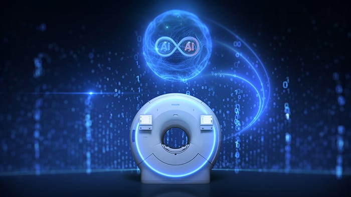 Dual AI engines in SmartSpeed Precise -  